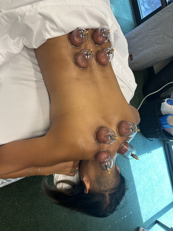 myofascial decompression, cupping, physical therapy, chronic pain