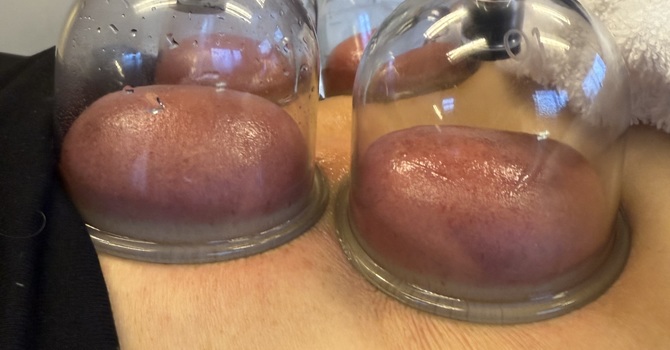 Lymphatic Drainage and Neuropathy image